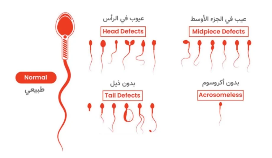 أصعب حالات العقم